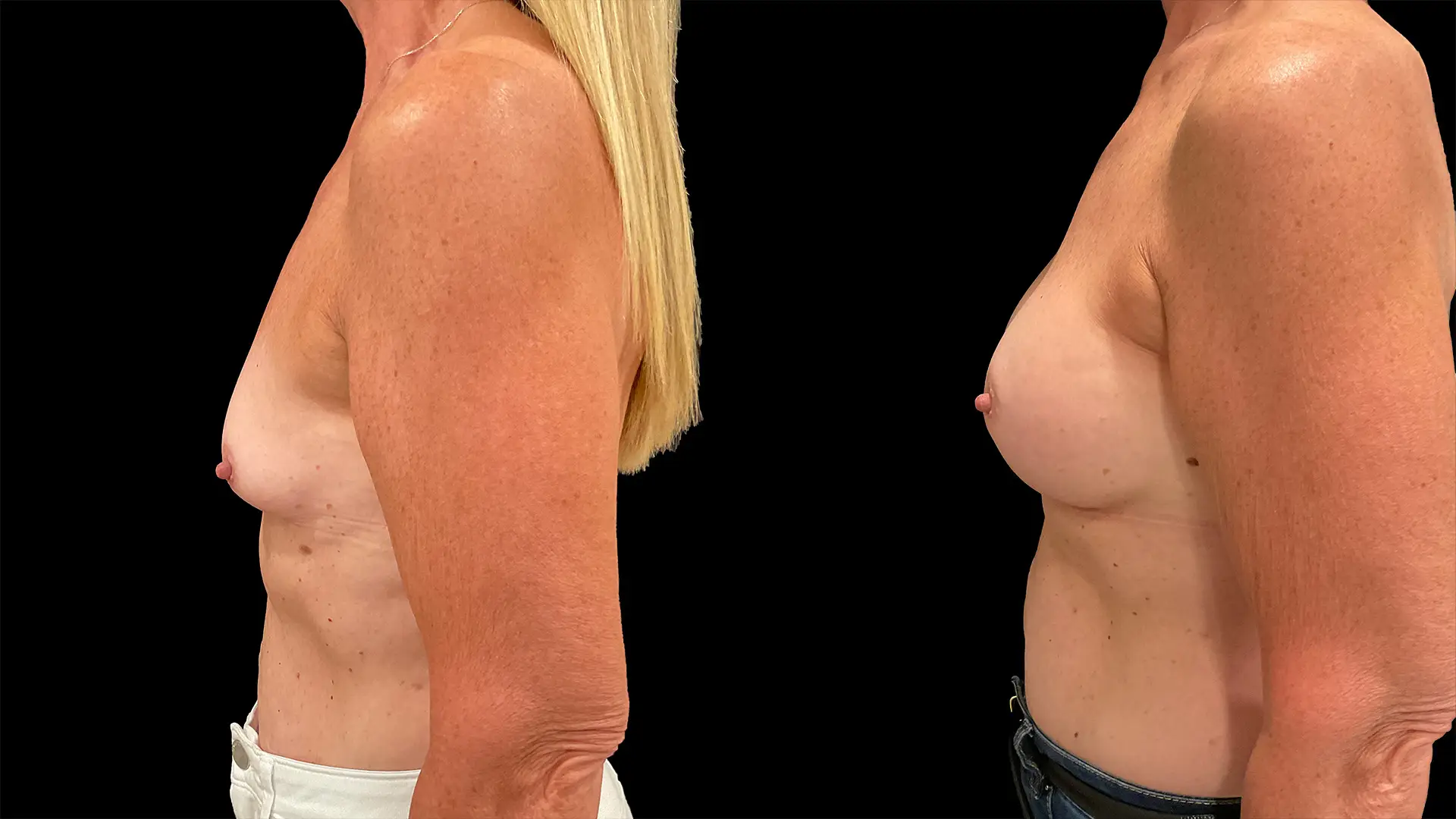 Left Comparison 1920x1080